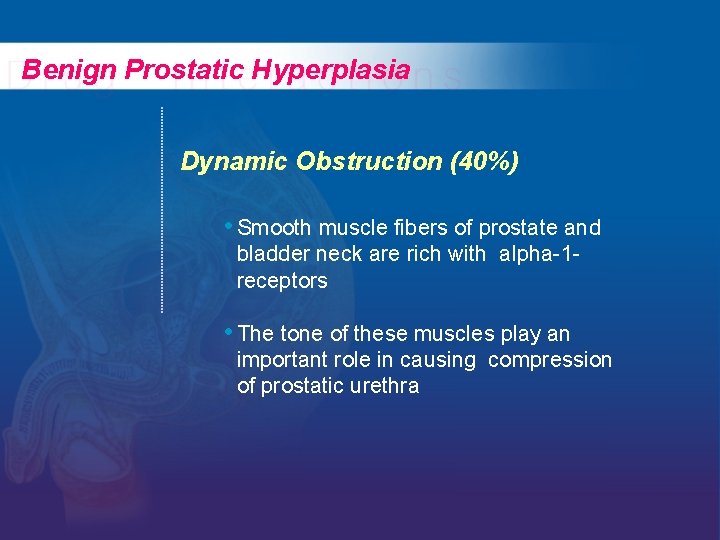 Benign Prostatic Hyperplasia Dynamic Obstruction (40%) • Smooth muscle fibers of prostate and bladder Benign Prostatic Hyperplasia Dynamic Obstruction (40%) • Smooth muscle fibers of prostate and bladder