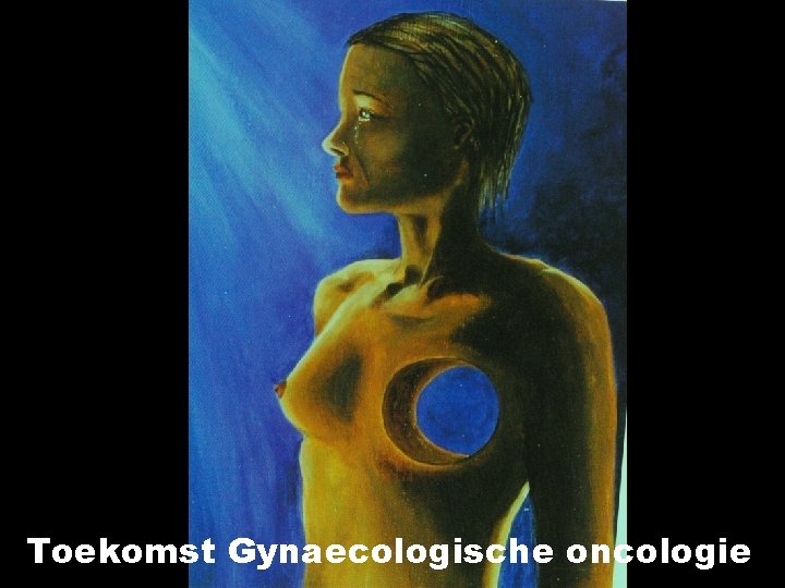 Toekomst Gynaecologische oncologie 