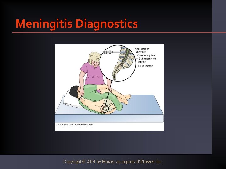 Meningitis Diagnostics Copyright © 2014 by Mosby, an imprint of Elsevier Inc. 