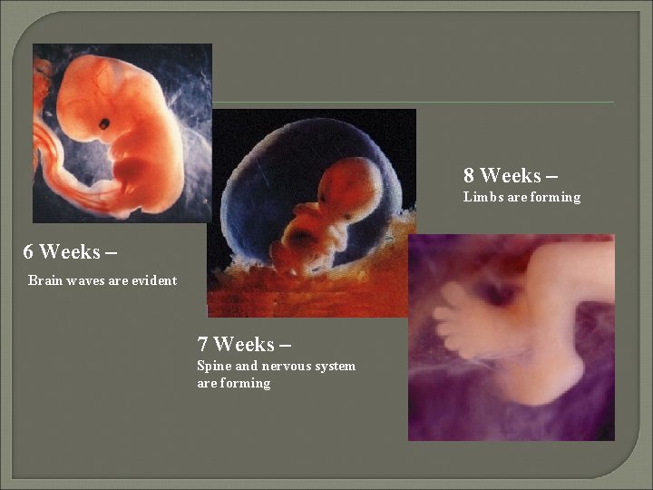 8 Weeks – Limbs are forming 6 Weeks – Brain waves are evident 7