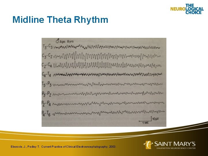 Midline Theta Rhythm Ebersole. J. , Pedley T. Current Practice of Clinical Electroencephalography. 2003.