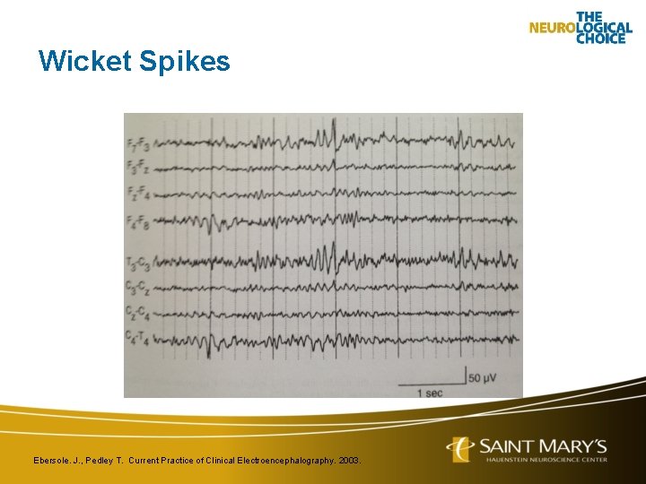 Wicket Spikes Ebersole. J. , Pedley T. Current Practice of Clinical Electroencephalography. 2003. 
