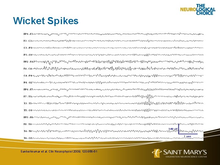 Wicket Spikes Santoshkumar et al. Clin Neurophysiol 2009; 120: 856 -61 