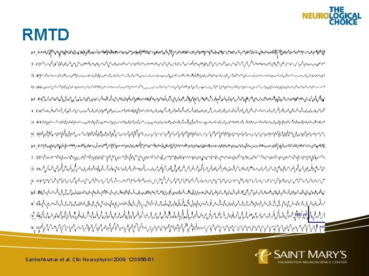 RMTD Santoshkumar et al. Clin Neurophysiol 2009; 120: 856 -61 