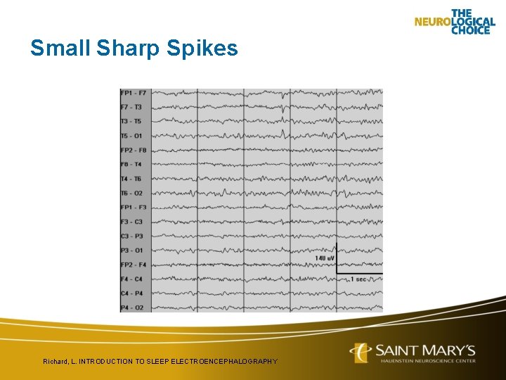 Small Sharp Spikes Richard, L. INTRODUCTION TO SLEEP ELECTROENCEPHALOGRAPHY 