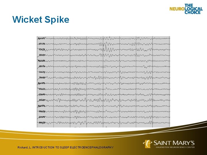 Wicket Spike Richard, L. INTRODUCTION TO SLEEP ELECTROENCEPHALOGRAPHY 