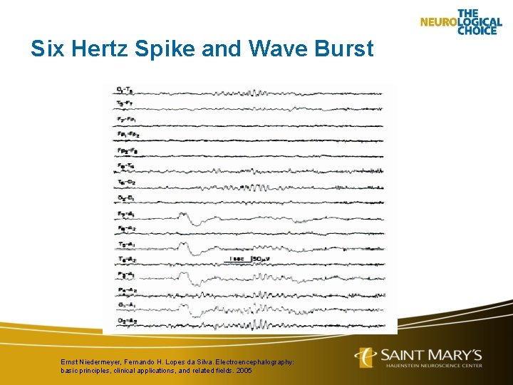 Six Hertz Spike and Wave Burst Ernst Niedermeyer, Fernando H. Lopes da Silva. Electroencephalography: