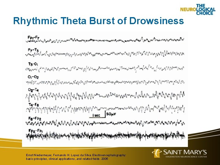 Rhythmic Theta Burst of Drowsiness Ernst Niedermeyer, Fernando H. Lopes da Silva. Electroencephalography: basic