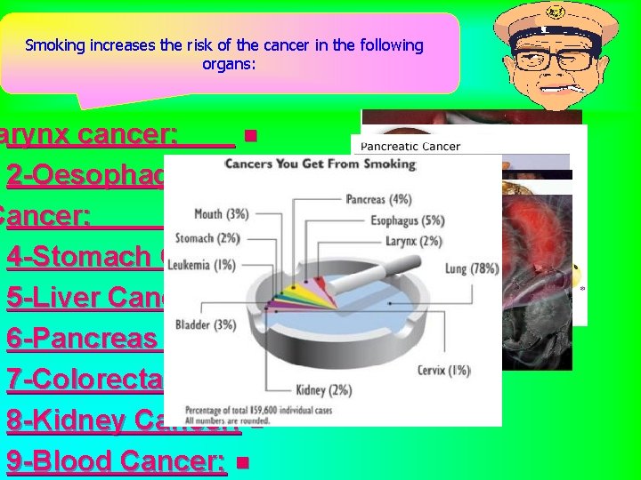 Smoking increases the risk of the cancer in the following organs: arynx cancer: n