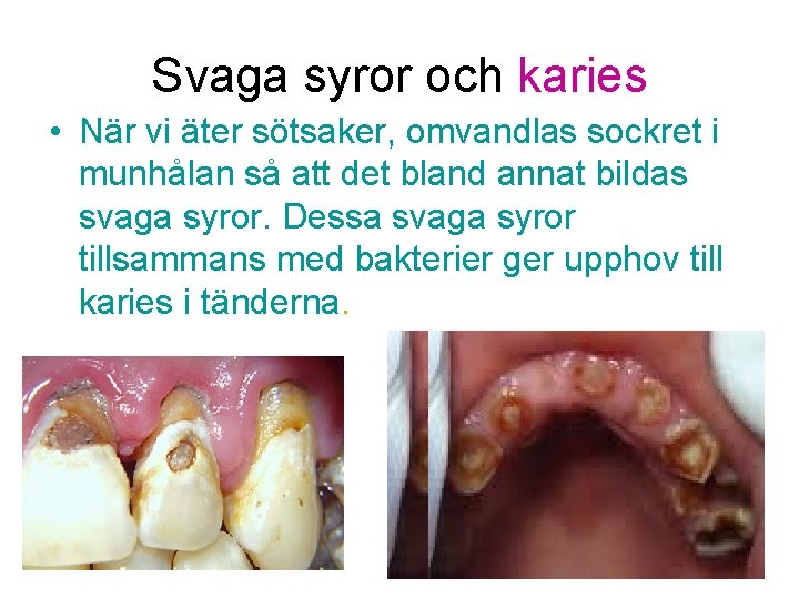 Svaga syror och karies • När vi äter sötsaker, omvandlas sockret i munhålan så