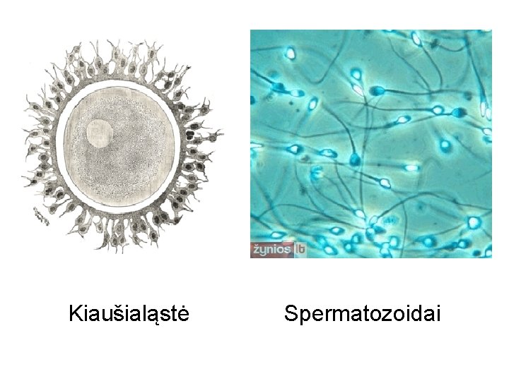 Kiaušialąstė Spermatozoidai 