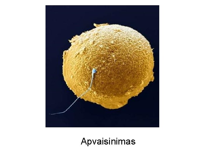 Apvaisinimas 