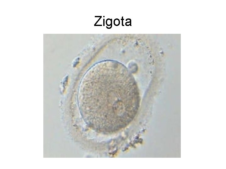 Zigota 