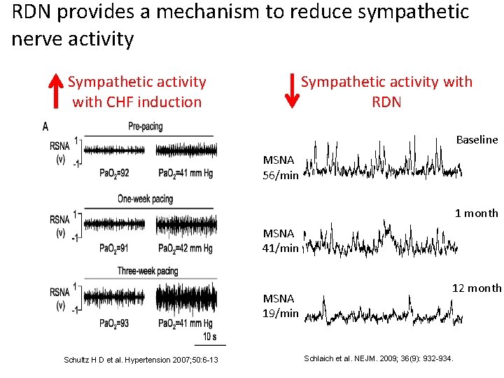 RDN provides a mechanism to reduce sympathetic nerve activity Sympathetic activity with CHF induction