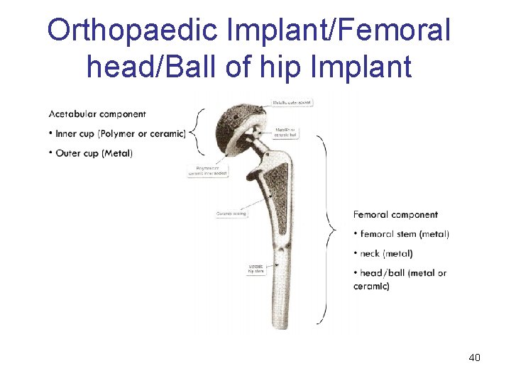 Orthopaedic Implant/Femoral head/Ball of hip Implant 40 