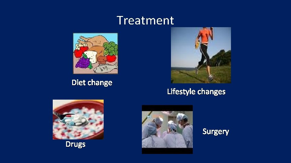 Treatment Diet change Lifestyle changes Surgery Drugs 