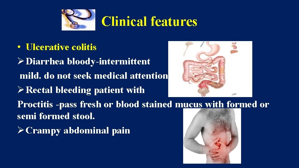 Clinical features • Ulcerative colitis Ø Diarrhea bloody-intermittent mild. do not seek medical attention.