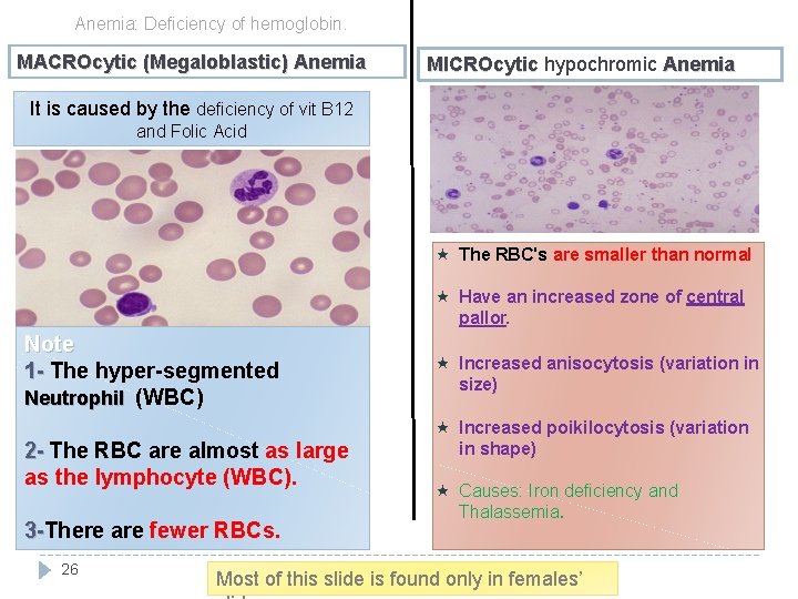 Anemia: Deficiency of hemoglobin. MACROcytic (Megaloblastic) Anemia MICROcytic hypochromic Anemia MICROcytic It is caused