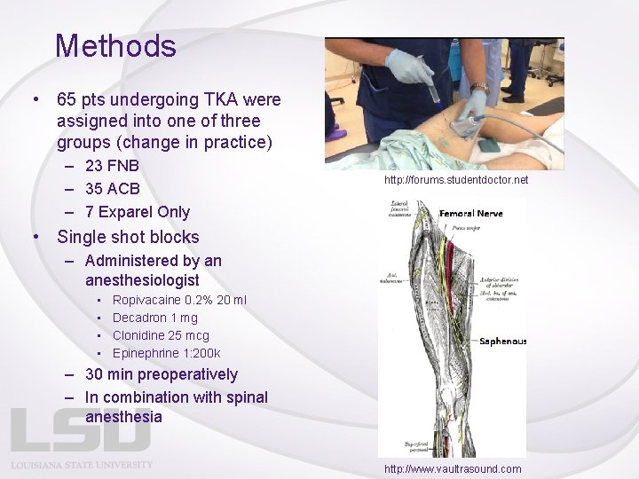Methods • 65 pts undergoing TKA were assigned into one of three groups (change