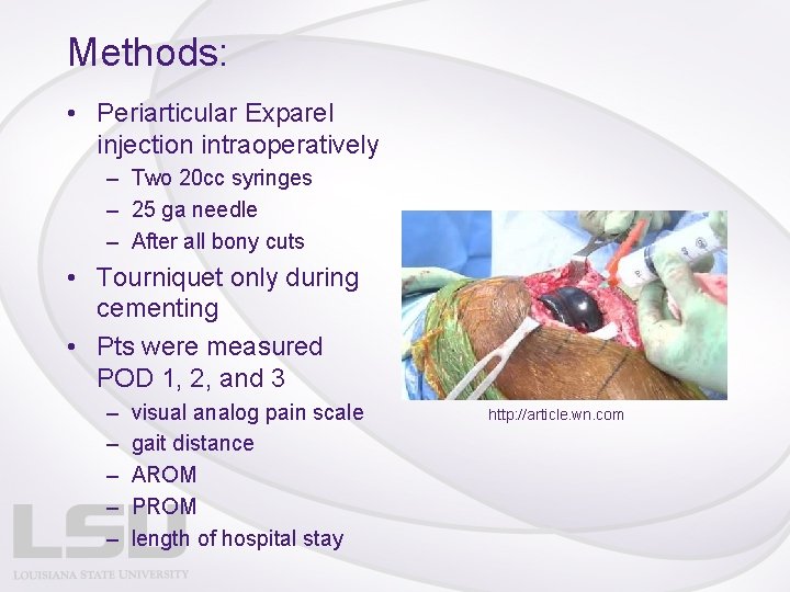 Methods: • Periarticular Exparel injection intraoperatively – Two 20 cc syringes – 25 ga