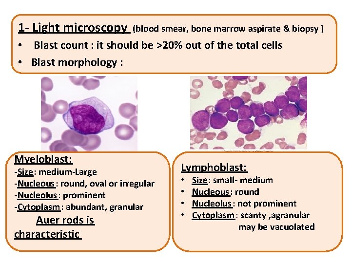 1 - Light microscopy (blood smear, bone marrow aspirate & biopsy ) • Blast