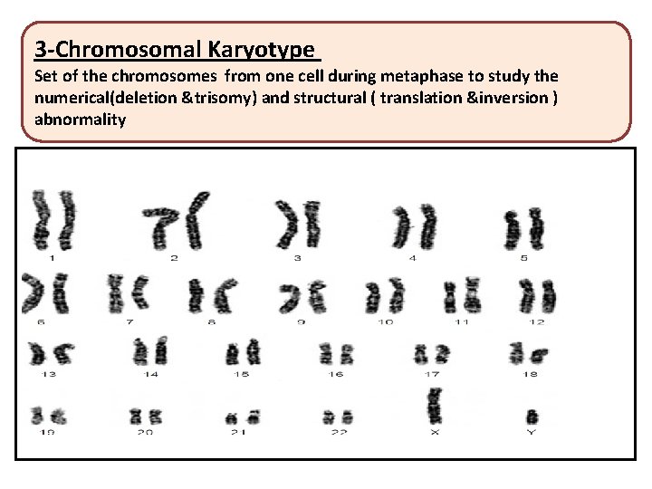 3 -Chromosomal Karyotype Set of the chromosomes from one cell during metaphase to study