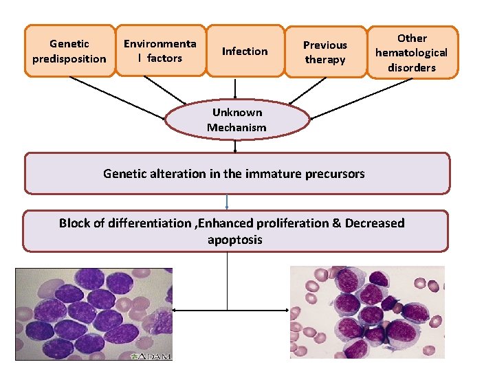 Genetic predisposition Environmenta l factors Infection Previous therapy Other hematological disorders Unknown Mechanism Genetic