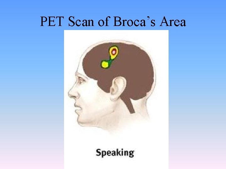 PET Scan of Broca’s Area PET Scan of Broca’s Area