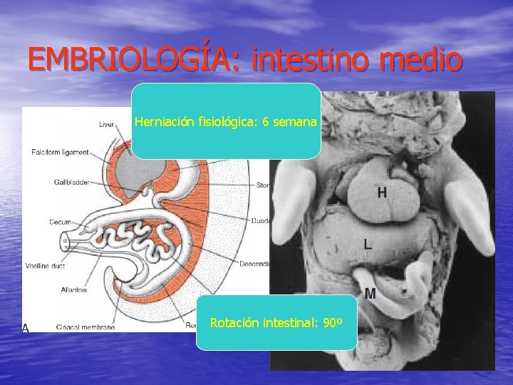 EMBRIOLOGÍA: intestino medio Herniación fisiológica: 6 semana Rotación intestinal: 90º 