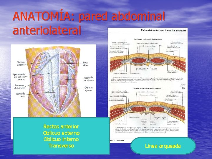 ANATOMÍA: pared abdominal anteriolateral Rectos anterior Oblicuo externo Oblicuo interno Transverso Línea arqueada 