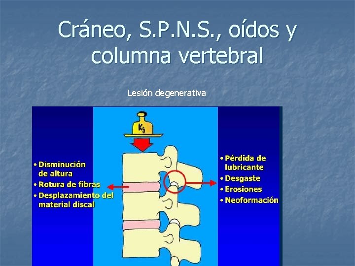 Cráneo, S. P. N. S. , oídos y columna vertebral Lesión degenerativa 