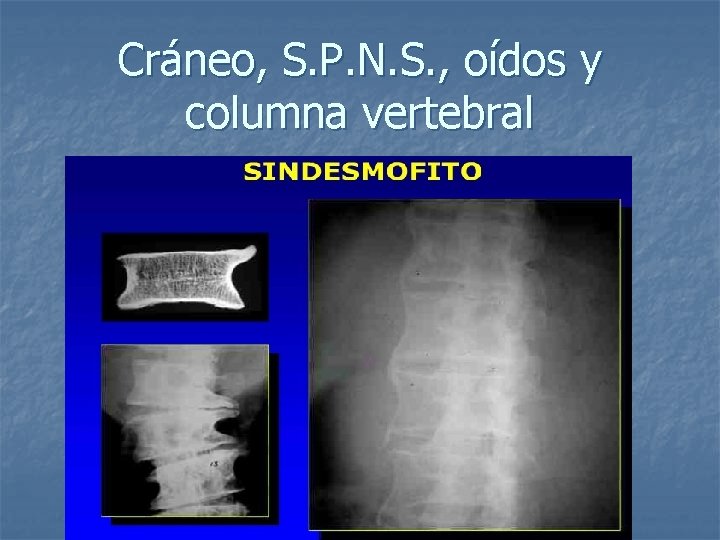 Cráneo, S. P. N. S. , oídos y columna vertebral 
