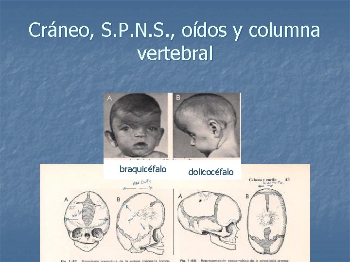 Cráneo, S. P. N. S. , oídos y columna vertebral braquicéfalo dolicocéfalo 