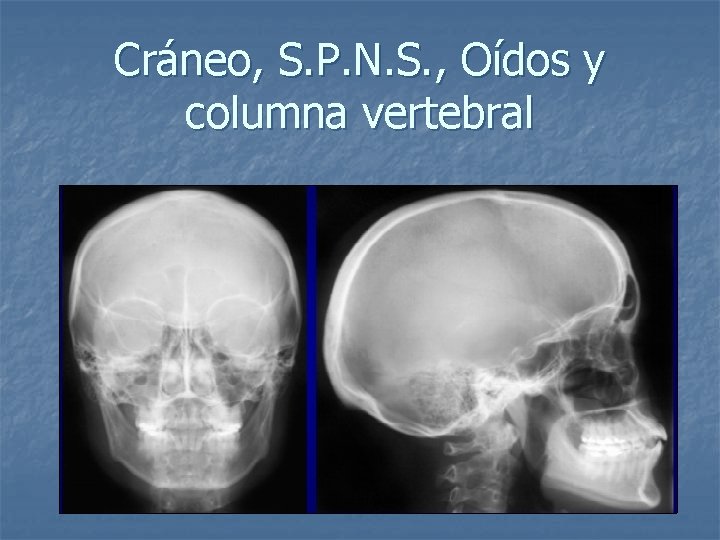 Cráneo, S. P. N. S. , Oídos y columna vertebral 
