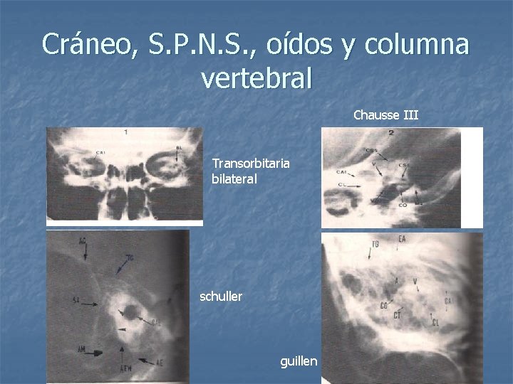 Cráneo, S. P. N. S. , oídos y columna vertebral Chausse III Transorbitaria bilateral