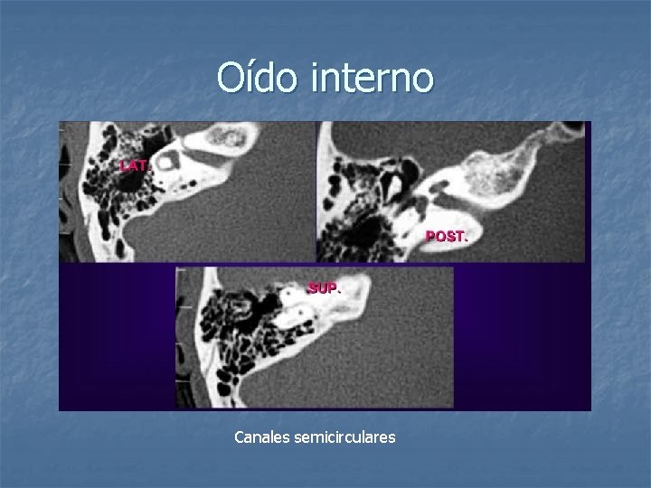 Oído interno Canales semicirculares 