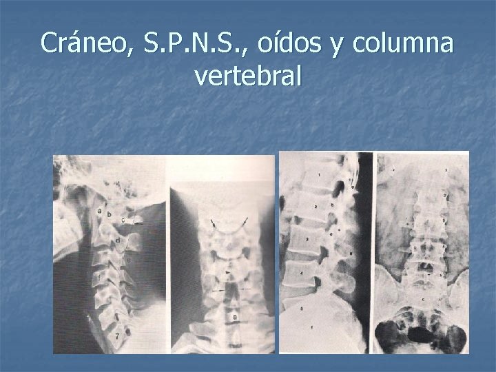 Cráneo, S. P. N. S. , oídos y columna vertebral 