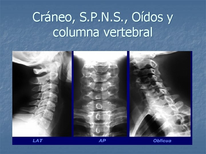 Cráneo, S. P. N. S. , Oídos y columna vertebral 