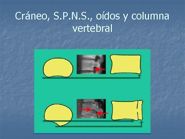 Cráneo, S. P. N. S. , oídos y columna vertebral 