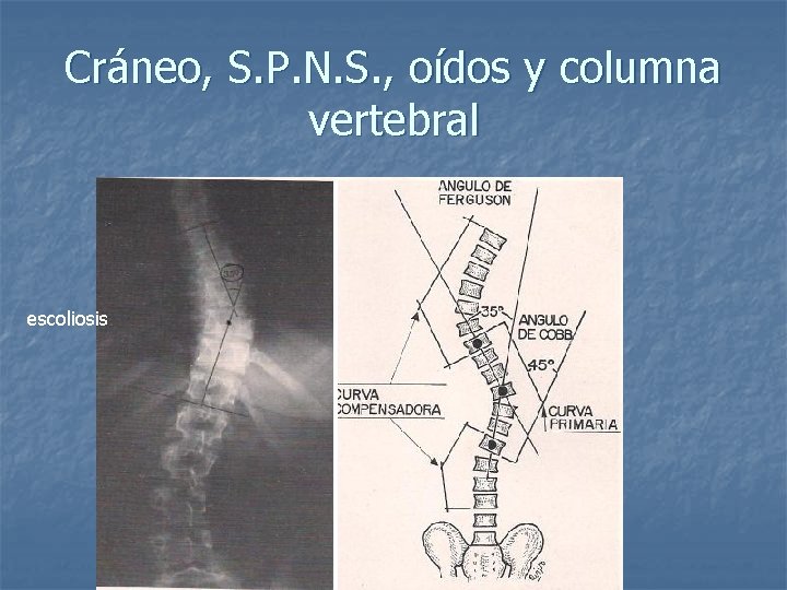 Cráneo, S. P. N. S. , oídos y columna vertebral escoliosis 