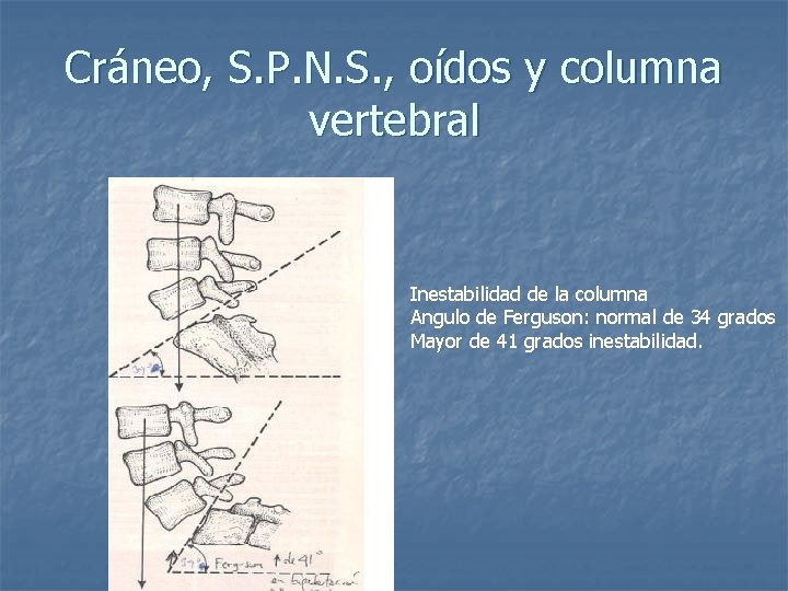 Cráneo, S. P. N. S. , oídos y columna vertebral Inestabilidad de la columna