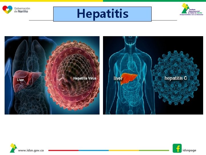 Hepatitis 