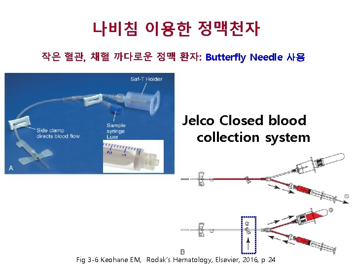나비침 이용한 정맥천자 작은 혈관, 채혈 까다로운 정맥 환자: Butterfly Needle 사용 Jelco Closed