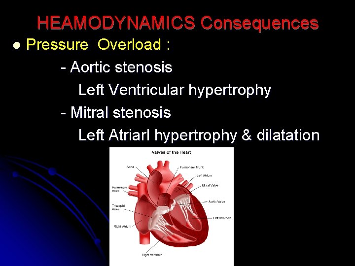 HEAMODYNAMICS Consequences l Pressure Overload : - Aortic stenosis Left Ventricular hypertrophy - Mitral