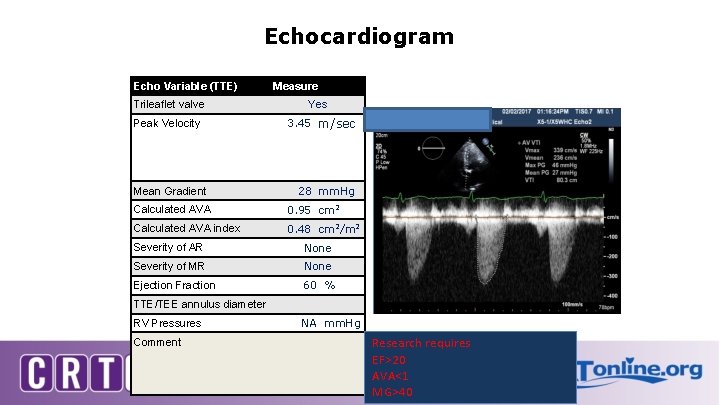 Echocardiogram Echo Variable (TTE) Measure Trileaflet valve Yes Peak Velocity 3. 45 m/sec Mean