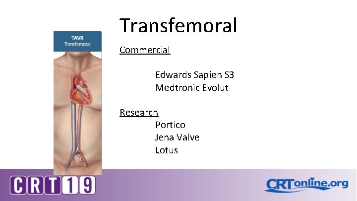 Transfemoral Commercial Edwards Sapien S 3 Medtronic Evolut Research Portico Jena Valve Lotus 
