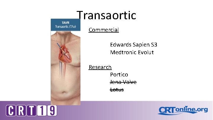 Transaortic Commercial Edwards Sapien S 3 Medtronic Evolut Research Portico Jena Valve Lotus 