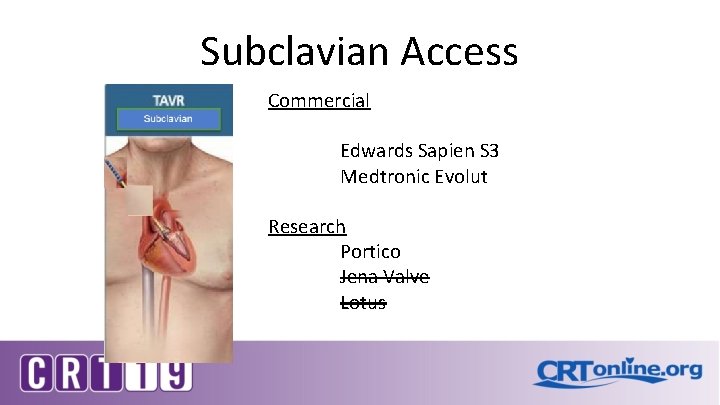 Subclavian Access Commercial Edwards Sapien S 3 Medtronic Evolut Research Portico Jena Valve Lotus