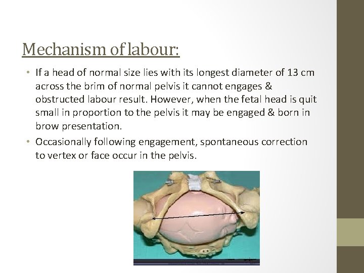 Mechanism of labour: • If a head of normal size lies with its longest