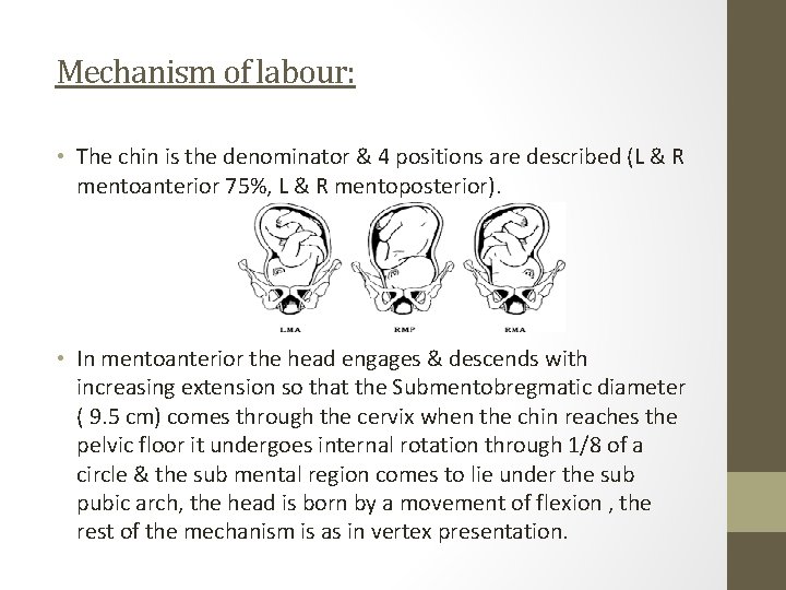 Mechanism of labour: • The chin is the denominator & 4 positions are described